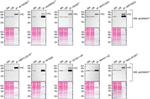 CK1 alpha Antibody in Western Blot (WB)
