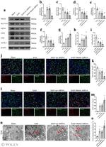 ACSL4 Antibody in Western Blot (WB)