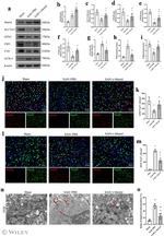 ACSL4 Antibody in Western Blot (WB)