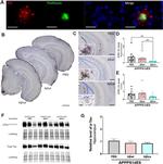 Phospho-Tau (Ser202, Thr205) Monoclonal Antibody (AT8), Biotin