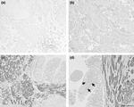 Caveolin 1 Antibody in Immunohistochemistry (IHC)