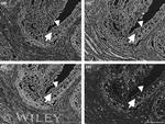 Caveolin 1 Antibody in Immunohistochemistry (IHC)