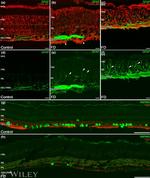 GFAP Antibody in Immunohistochemistry (PFA fixed) (IHC (PFA))