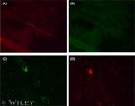 LYVE1 Antibody in Immunohistochemistry (IHC)