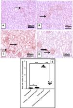 LC3B Antibody in Immunohistochemistry (Paraffin) (IHC (P))