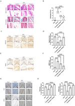 Aggrecan Neo Antibody in Immunohistochemistry (Paraffin) (IHC (P))