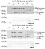 Collagen I Antibody in Western Blot (WB)
