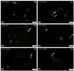 NPY Antibody in Immunohistochemistry (Frozen) (IHC (F))