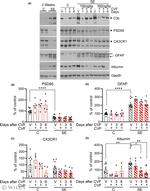 CX3CR1 Antibody in Western Blot (WB)