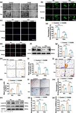 p19ARF Antibody in Western Blot (WB)