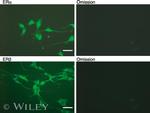 Estrogen Receptor beta Antibody in Immunohistochemistry (IHC)