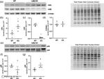 IkB beta Antibody in Western Blot (WB)