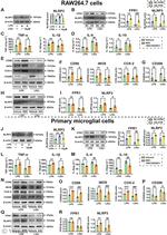 NLRP3 Antibody in Western Blot (WB)