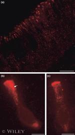 TRPV1 Antibody in Immunohistochemistry (IHC)