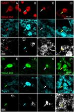 TRPV1 Antibody in Immunocytochemistry (ICC/IF)