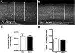 Parvalbumin Antibody in Immunohistochemistry (IHC)