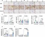 Arginase 1 Antibody in Immunohistochemistry (Paraffin) (IHC (P))