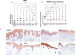 MMP28 Antibody in Immunohistochemistry (Paraffin) (IHC (P))