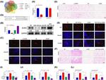 ACER2 Antibody in Western Blot (WB)
