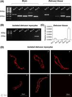 KCNQ5 Antibody in Immunocytochemistry (ICC/IF)