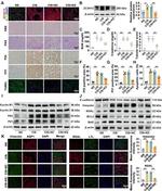 ZC3H13 Antibody in Western Blot (WB)