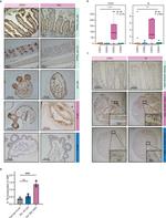 CPS1 Antibody in Immunohistochemistry (Paraffin) (IHC (P))