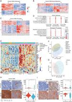 CTLA-4 Antibody in Immunohistochemistry (Paraffin) (IHC (P))
