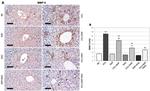 MMP9 Antibody in Immunohistochemistry (Paraffin) (IHC (P))