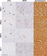 GFAP Antibody in Immunohistochemistry (Paraffin) (IHC (P))