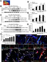 Myeloperoxidase Antibody in Western Blot (WB)