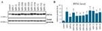 Profilin 1 Antibody in Western Blot (WB)
