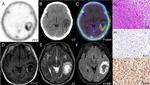 GRPR Antibody in Immunohistochemistry (IHC)