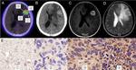GRPR Antibody in Immunohistochemistry (IHC)
