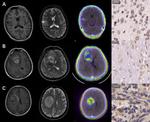 GRPR Antibody in Immunohistochemistry (Paraffin) (IHC (P))