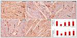 Bcl-2 Antibody in Immunohistochemistry (Paraffin) (IHC (P))
