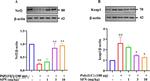 Nrf2 Antibody in Western Blot (WB)