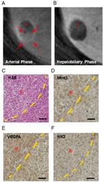 HK2 Antibody in Immunohistochemistry (Paraffin) (IHC (P))