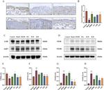 LOR Antibody in Western Blot, Immunohistochemistry (Paraffin) (WB, IHC (P))