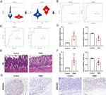 UBC3B Antibody in Immunohistochemistry (Paraffin) (IHC (P))