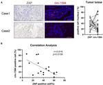 ZC3HAV1 Antibody in Immunohistochemistry (Paraffin) (IHC (P))