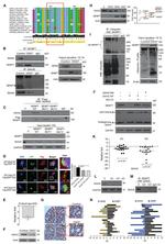 SENP7 Antibody in Western Blot, Immunoprecipitation (WB, IP)