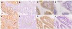 CHI3L1 Antibody in Immunohistochemistry (Paraffin) (IHC (P))