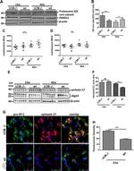 STX17 Antibody in Western Blot (WB)