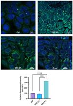 SLC15A4 Antibody in Immunocytochemistry (ICC/IF)