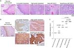 PORCN Antibody in Immunohistochemistry (Paraffin) (IHC (P))