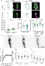 DCC Antibody in Neutralization (Neu)