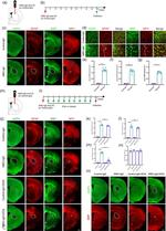 Aquaporin 4 Antibody in Immunohistochemistry (IHC)
