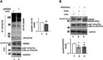 Spastin Antibody in Western Blot (WB)