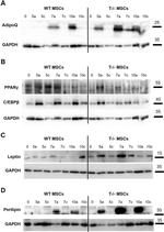 Perilipin 1 Antibody in Western Blot (WB)