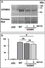 GTPBP2 Antibody in Western Blot (WB)